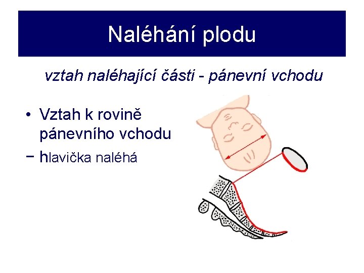 Naléhání plodu vztah naléhající části - pánevní vchodu • Vztah k rovině pánevního vchodu