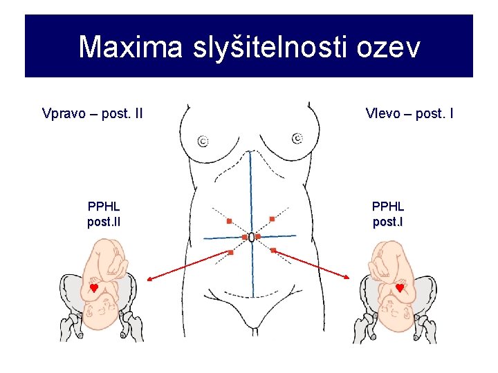 Maxima slyšitelnosti ozev Vpravo – post. II PPHL post. II Vlevo – post. I