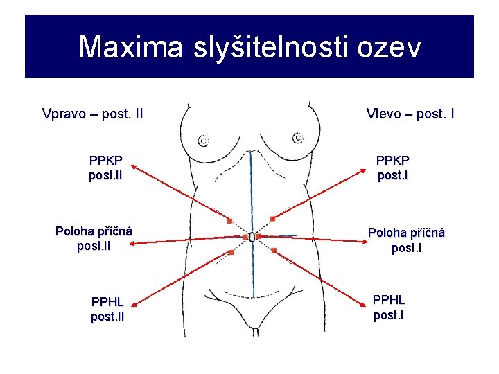 Maxima slyšitelnosti ozev Vpravo – post. II PPKP post. II Poloha příčná post. II