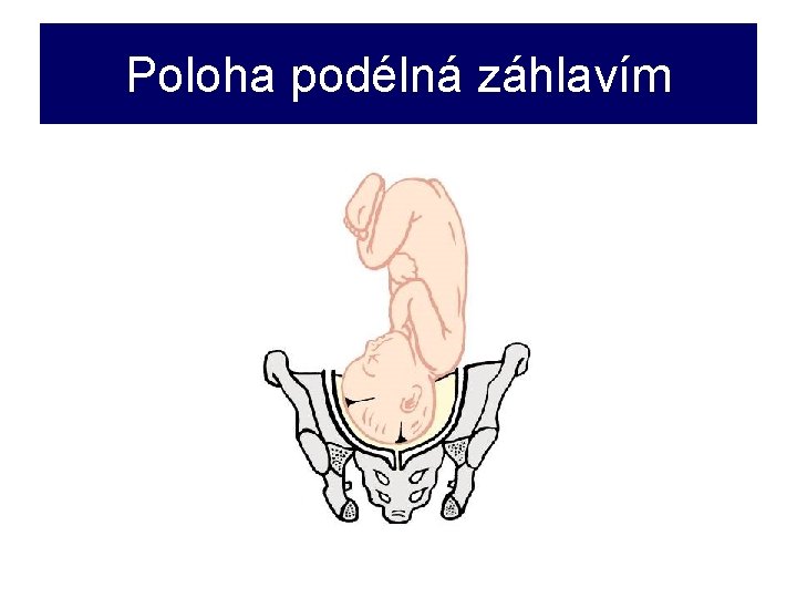 Poloha podélná záhlavím 