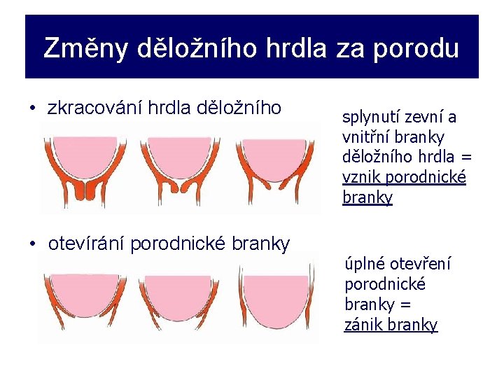 Změny děložního hrdla za porodu • zkracování hrdla děložního • otevírání porodnické branky splynutí