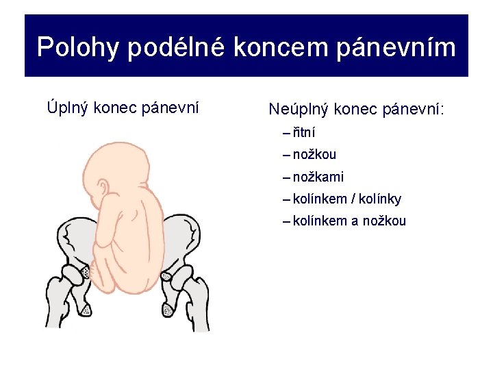 Polohy podélné koncem pánevním Úplný konec pánevní Neúplný konec pánevní: – řitní – nožkou