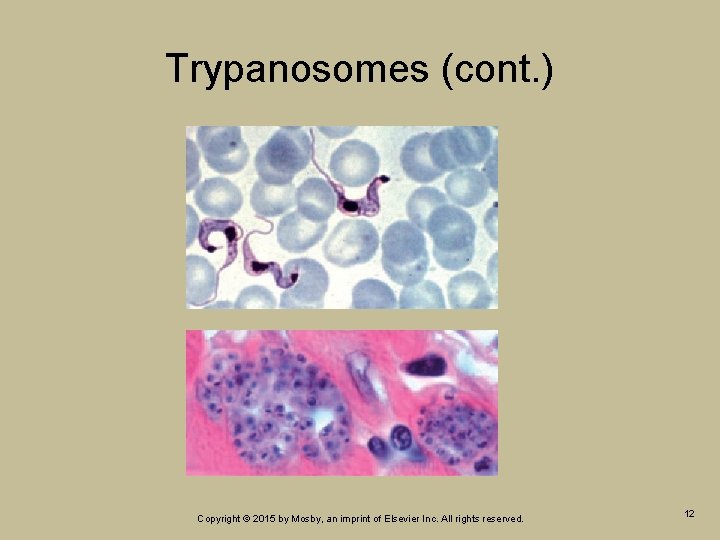Trypanosomes (cont. ) Copyright © 2015 by Mosby, an imprint of Elsevier Inc. All Trypanosomes (cont. ) Copyright © 2015 by Mosby, an imprint of Elsevier Inc. All