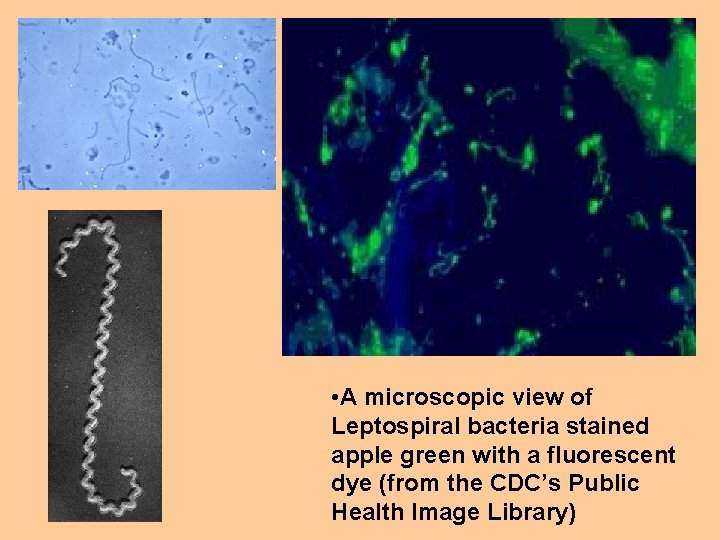  • A microscopic view of Leptospira. I bacteria stained apple green with a