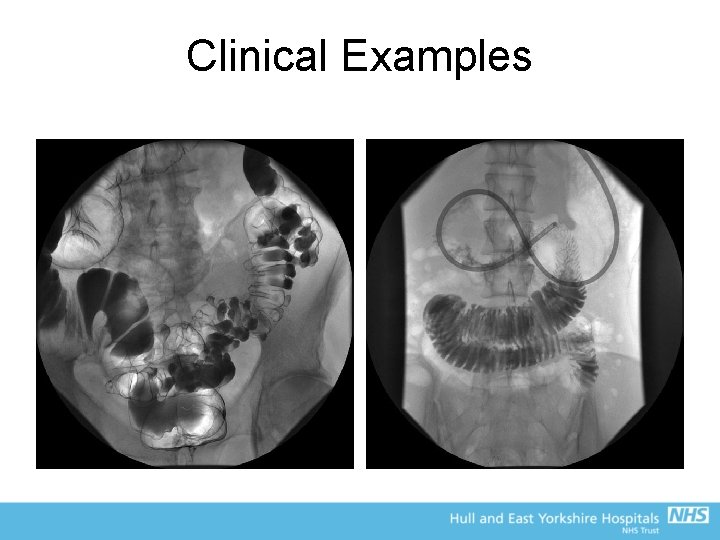 Clinical Examples 