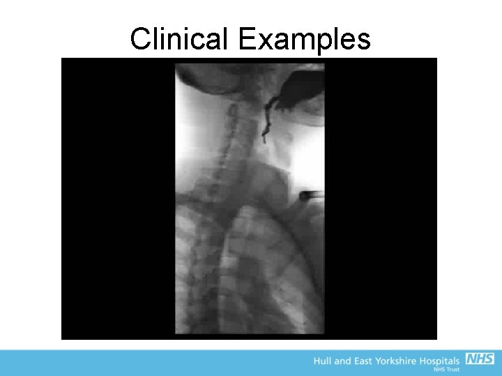 Clinical Examples 