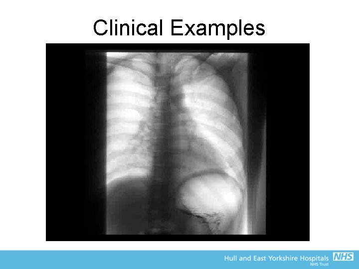 Clinical Examples 