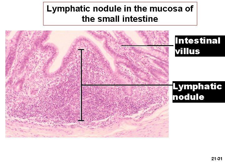 Lymphatic nodule in the mucosa of the small intestine Intestinal villus Lymphatic nodule 21