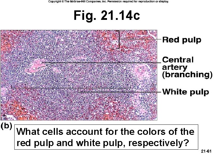 Fig. 21. 14 c What cells account for the colors of the red pulp