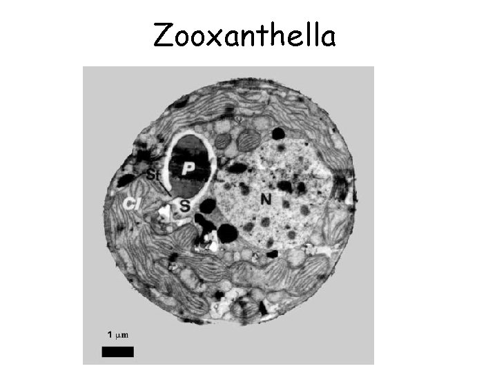 Zooxanthella 