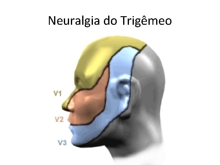 Neuralgia do Trigêmeo Neuralgia do Trigêmeo