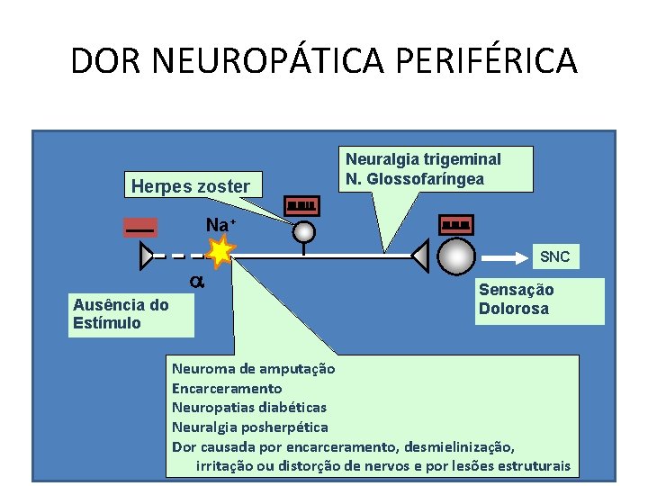 DOR NEUROPÁTICA PERIFÉRICA Herpes zoster Neuralgia trigeminal N. Glossofaríngea Na+ Ausência do Estímulo SNC DOR NEUROPÁTICA PERIFÉRICA Herpes zoster Neuralgia trigeminal N. Glossofaríngea Na+ Ausência do Estímulo SNC