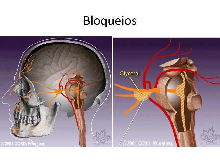 Bloqueios Bloqueios