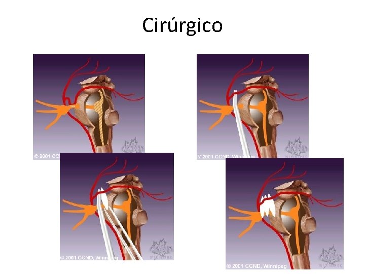 Cirúrgico Cirúrgico