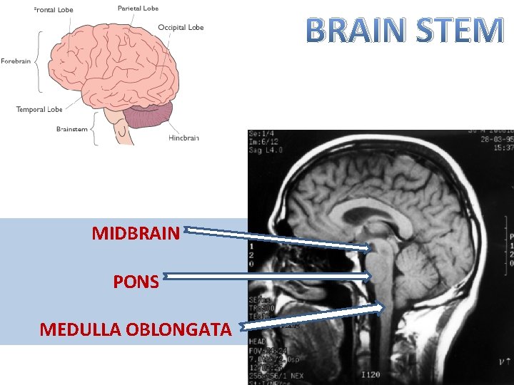 BRAIN STEM MIDBRAIN PONS MEDULLA OBLONGATA 