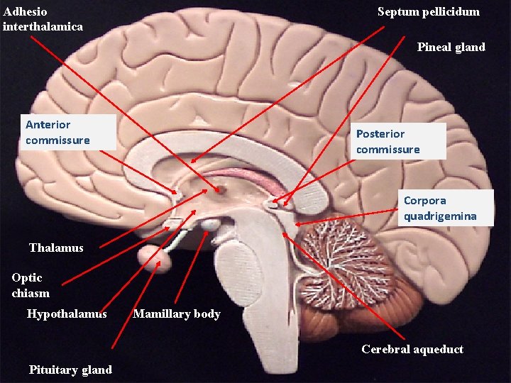 Adhesio interthalamica Septum pellicidum Pineal gland Anterior commissure Posterior commissure Corpora quadrigemina AC Thalamus