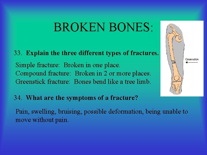 BROKEN BONES: 33. Explain the three different types of fractures. Simple fracture: Broken in