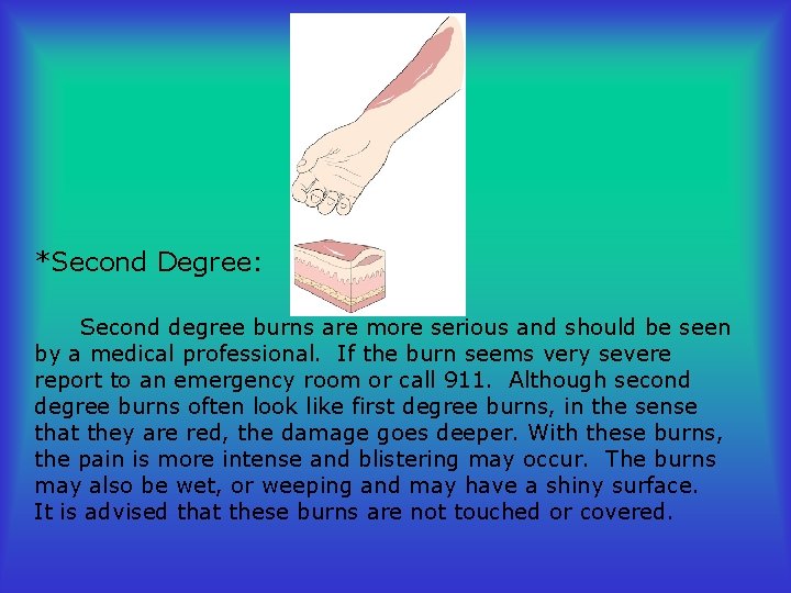 *Second Degree: Second degree burns are more serious and should be seen by