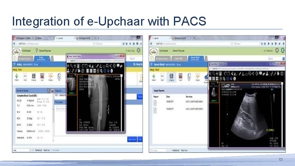 Integration of e-Upchaar with PACS 13 