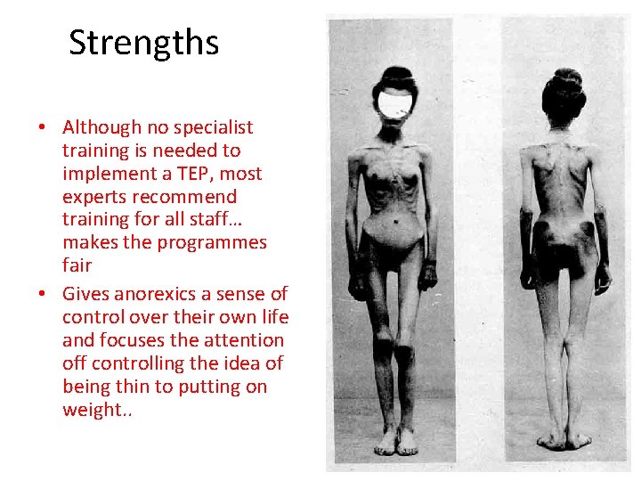 Strengths • Although no specialist training is needed to implement a TEP, most experts