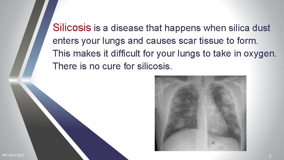 Silicosis is a disease that happens when silica dust enters your lungs and causes