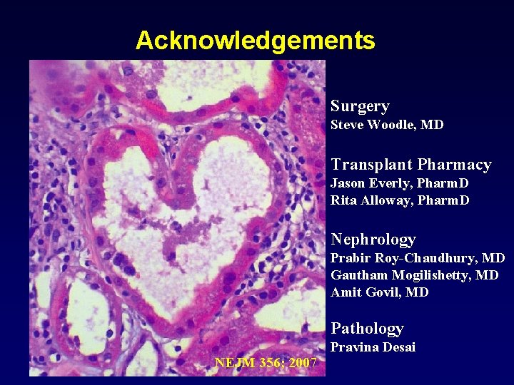 Acknowledgements Surgery Steve Woodle, MD Transplant Pharmacy Jason Everly, Pharm. D Rita Alloway, Pharm. Acknowledgements Surgery Steve Woodle, MD Transplant Pharmacy Jason Everly, Pharm. D Rita Alloway, Pharm.