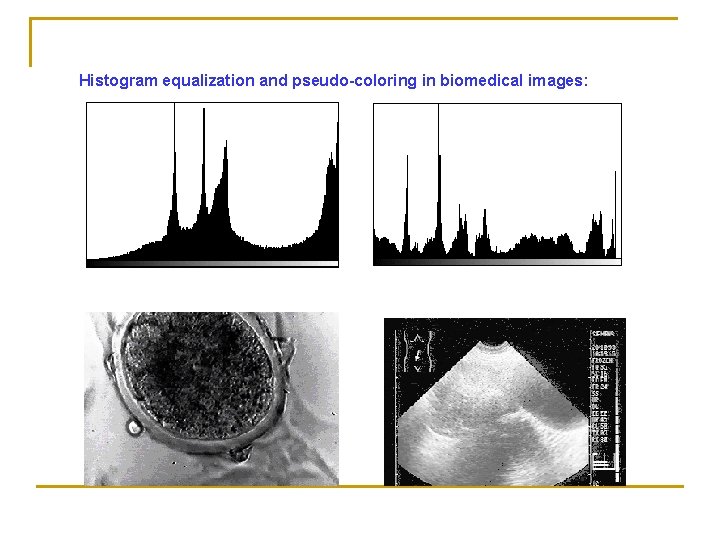 Histogram equalization and pseudo-coloring in biomedical images: 