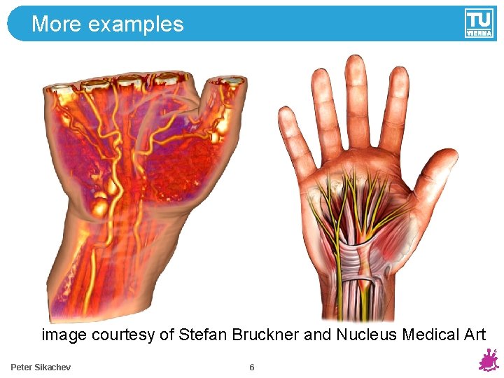More examples image courtesy of Stefan Bruckner and Nucleus Medical Art Peter Sikachev 6