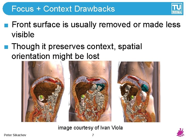 Focus + Context Drawbacks Front surface is usually removed or made less visible Though