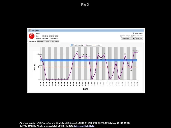 Fig 3 American Journal of Orthodontics and Dentofacial Orthopedics 2013 144533 -540 DOI: (10.