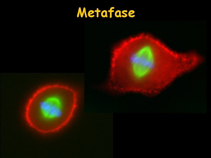 Metafase 