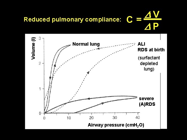 Volume (l) Reduced pulmonary compliance: Normal lung DV C = D P ALI RDS