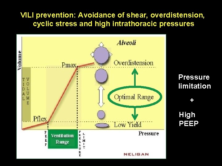 VILI prevention: Avoidance of shear, overdistension, cyclic stress and high intrathoracic pressures Pressure limitation