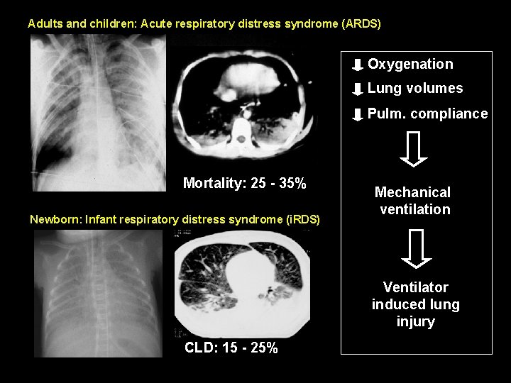 Adults and children: Acute respiratory distress syndrome (ARDS) Oxygenation Lung volumes Pulm. compliance Mortality: