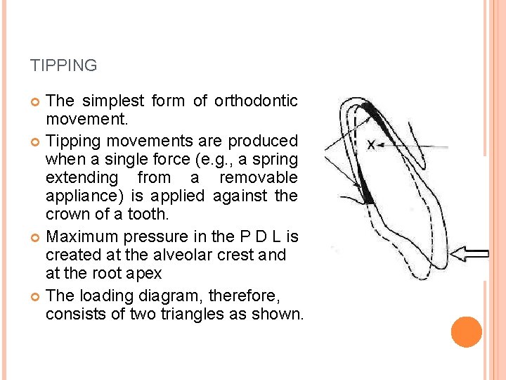TIPPING The simplest form of orthodontic movement. Tipping movements are produced when a single