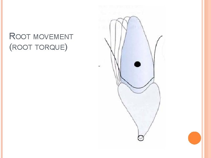 ROOT MOVEMENT (ROOT TORQUE) 