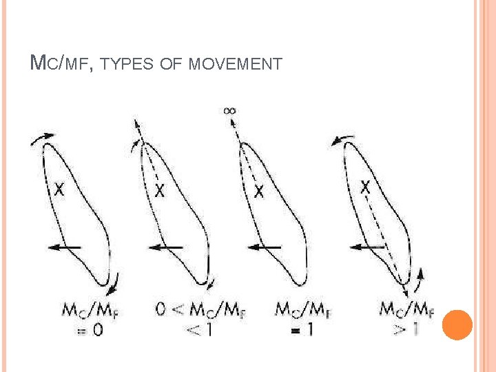 MC/MF, TYPES OF MOVEMENT 