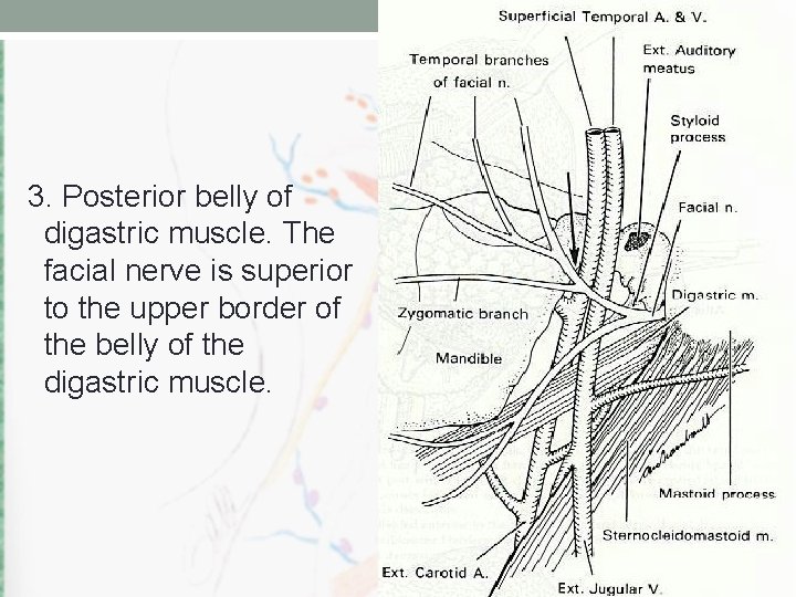 3. Posterior belly of digastric muscle. The facial nerve is superior to the upper