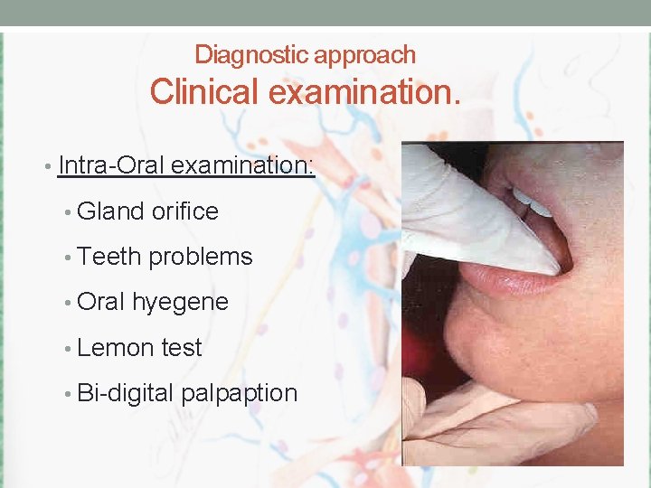 Diagnostic approach Clinical examination. • Intra-Oral examination: • Gland orifice • Teeth problems •