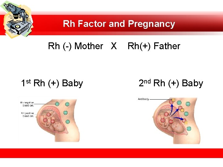 Rh Factor and Pregnancy Rh (-) Mother X 1 st Rh (+) Baby Rh(+)