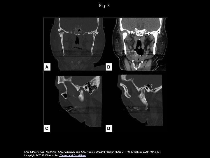 Fig. 3 Oral Surgery, Oral Medicine, Oral Pathology and Oral Radiology 2018 126301 -306