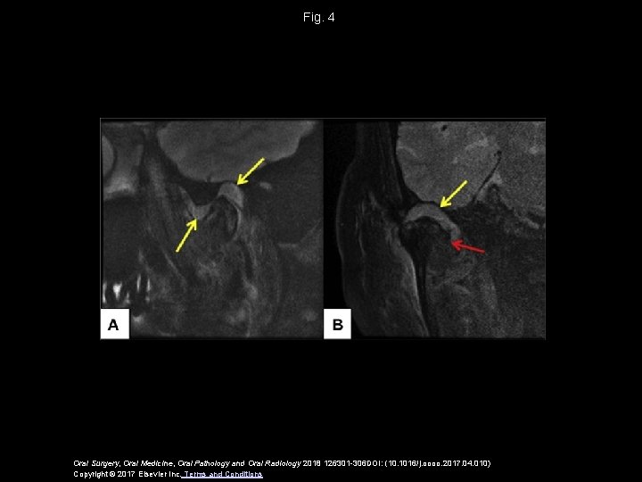 Fig. 4 Oral Surgery, Oral Medicine, Oral Pathology and Oral Radiology 2018 126301 -306