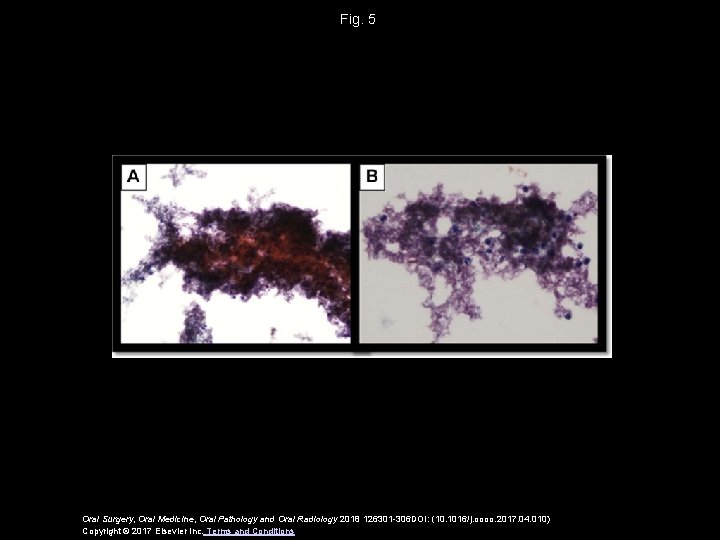 Fig. 5 Oral Surgery, Oral Medicine, Oral Pathology and Oral Radiology 2018 126301 -306