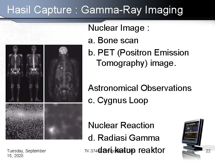 Hasil Capture : Gamma-Ray Imaging Nuclear Image : a. Bone scan b. PET (Positron