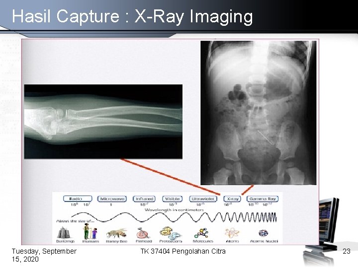 Hasil Capture : X-Ray Imaging Tuesday, September 15, 2020 TK 37404 Pengolahan Citra 23