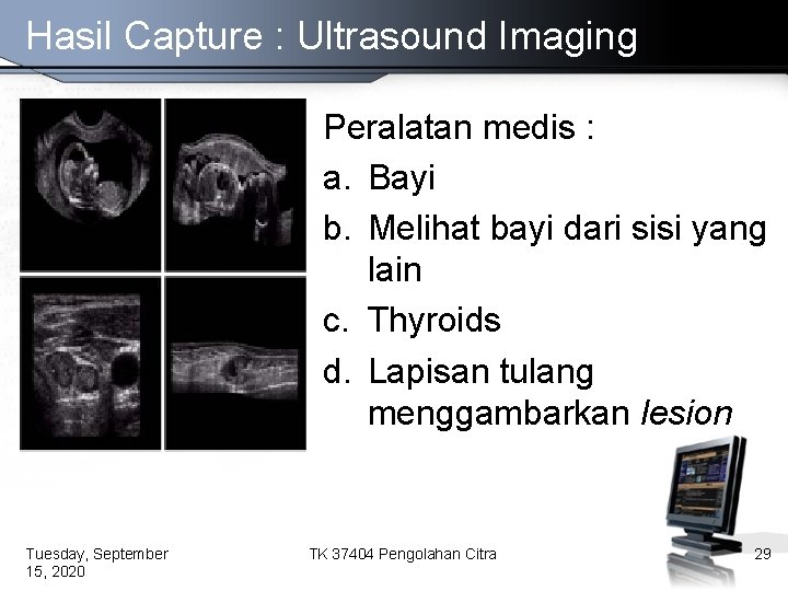 Hasil Capture : Ultrasound Imaging Peralatan medis : a. Bayi b. Melihat bayi dari
