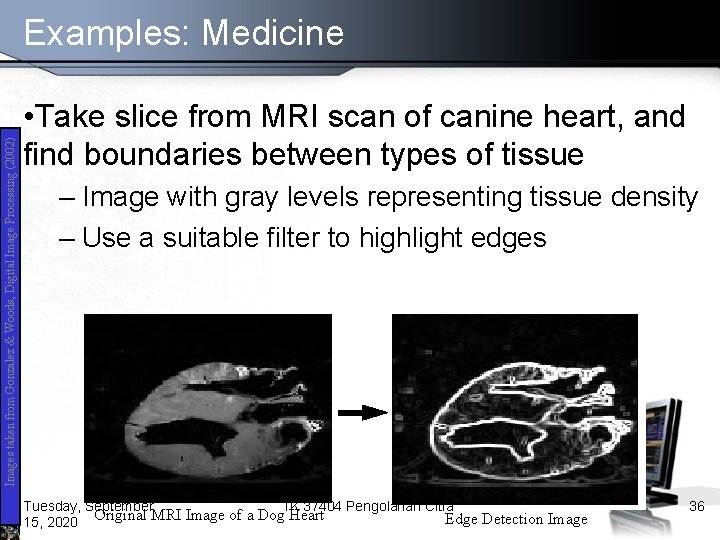 Images taken from Gonzalez & Woods, Digital Image Processing (2002) Examples: Medicine • Take