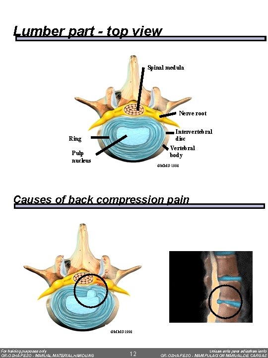 Lumber part - top view Spinal medula Nerve root Intervertebral disc Ring Vertebral body