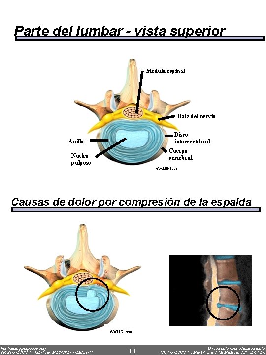 Parte del lumbar - vista superior Médula espinal Raíz del nervio Disco intervertebral Anillo