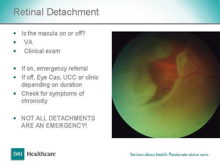 Retinal Detachment § Is the macula on or off? § VA § Clinical exam Retinal Detachment § Is the macula on or off? § VA § Clinical exam